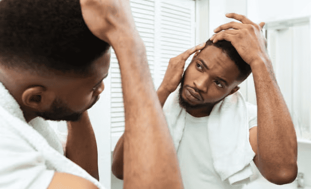 rimedi segni calvizie - Life&People Magazine