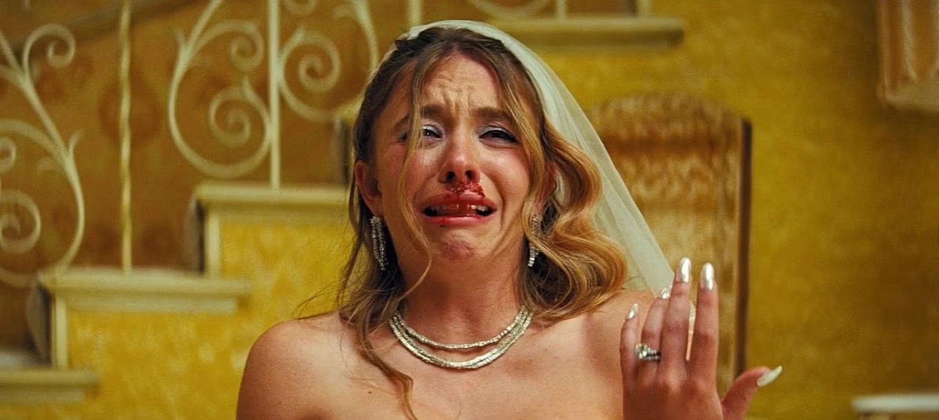 botox effect sydney sweeney