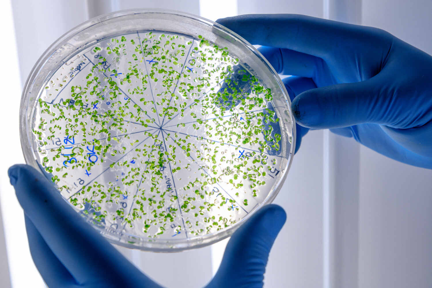 Stile alimentare migliore al mondo microbioma - Life&People Magazine
